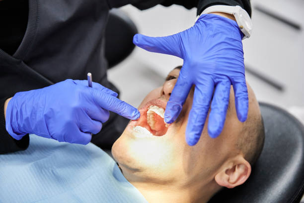 Best Emergency Tooth Extraction in Fruitland, NC